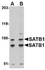 SATB1 Antibody in Western Blot (WB)