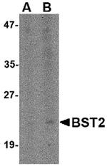 BST-2 Antibody in Western Blot (WB)