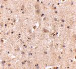 SAPAP2 Antibody in Immunohistochemistry (IHC)