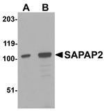 SAPAP2 Antibody in Western Blot (WB)