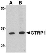 GRTP1 Antibody in Western Blot (WB)