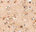 NANOS2 Antibody in Immunohistochemistry (IHC)