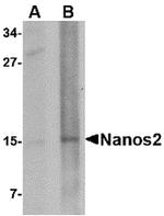 NANOS2 Antibody in Western Blot (WB)