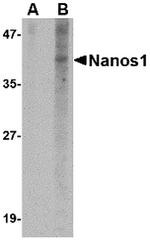 NANOS1 Antibody in Western Blot (WB)