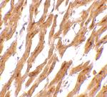 ASAH1 Antibody in Immunohistochemistry (IHC)