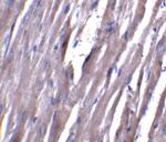 ASAH1 Antibody in Immunohistochemistry (IHC)