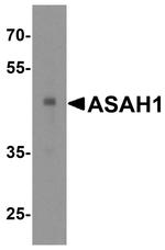 ASAH1 Antibody in Western Blot (WB)