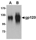 HIV1 gp120 Antibody in Western Blot (WB)