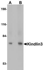 Kindlin 3 Antibody in Western Blot (WB)