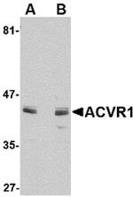 ACVR1 Antibody in Western Blot (WB)