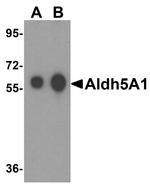 ALDH5A1 Antibody in Western Blot (WB)