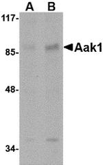 AAK1 Antibody in Western Blot (WB)