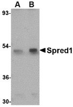 SPRED1 Antibody in Western Blot (WB)