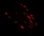 RKHD1 Antibody in Immunohistochemistry (IHC)