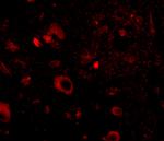 AIPL1 Antibody in Immunohistochemistry (IHC)