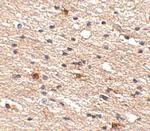 AIPL1 Antibody in Immunohistochemistry (IHC)