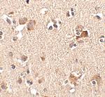 AIPL1 Antibody in Immunohistochemistry (IHC)