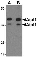 AIPL1 Antibody in Western Blot (WB)