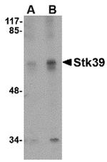 STK39 Antibody in Western Blot (WB)