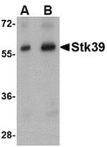 STK39 Antibody in Western Blot (WB)