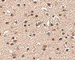 DACT2 Antibody in Immunohistochemistry (IHC)