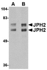 JPH2 Antibody in Western Blot (WB)