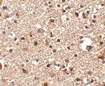 JPH4 Antibody in Immunohistochemistry (IHC)