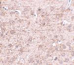 ZBTB1 Antibody in Immunohistochemistry (IHC)