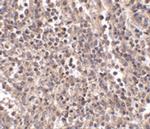 EBI3 Antibody in Immunohistochemistry (Paraffin) (IHC (P))