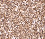 TREX1 Antibody in Immunohistochemistry (IHC)