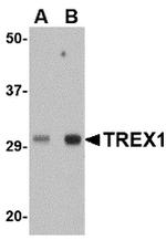 TREX1 Antibody in Western Blot (WB)