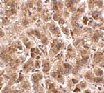 TREX2 Antibody in Immunohistochemistry (IHC)