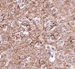 IL-16 Antibody in Immunohistochemistry (IHC)