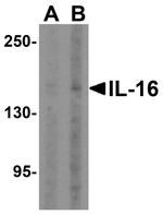 IL-16 Antibody in Western Blot (WB)