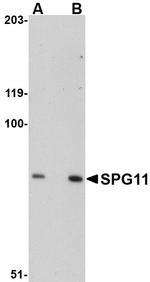 SPG11 Antibody in Western Blot (WB)