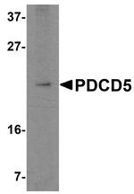 PDCD5 Antibody in Western Blot (WB)