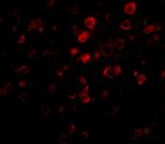 Bora Antibody in Immunocytochemistry (ICC/IF)