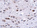 Bora Antibody in Immunohistochemistry (IHC)