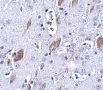 ATOH8 Antibody in Immunohistochemistry (IHC)