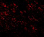 Amyloid Precursor Protein Antibody in Immunohistochemistry (IHC)