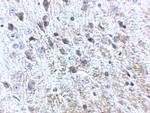 Amyloid Precursor Protein Antibody in Immunohistochemistry (IHC)