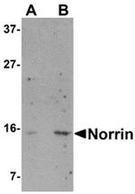 NDP Antibody in Western Blot (WB)