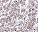 MATN1 Antibody in Immunohistochemistry (IHC)