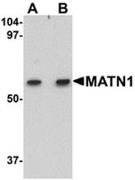 MATN1 Antibody in Western Blot (WB)