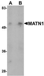 MATN1 Antibody in Western Blot (WB)