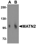 MATN2 Antibody in Western Blot (WB)