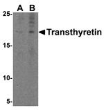 Transthyretin Antibody in Western Blot (WB)