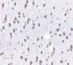 SCF Antibody in Immunohistochemistry (Paraffin) (IHC (P))