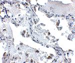 SH3BP4 Antibody in Immunohistochemistry (IHC)