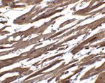 RSPO1 Antibody in Immunohistochemistry (Paraffin) (IHC (P))